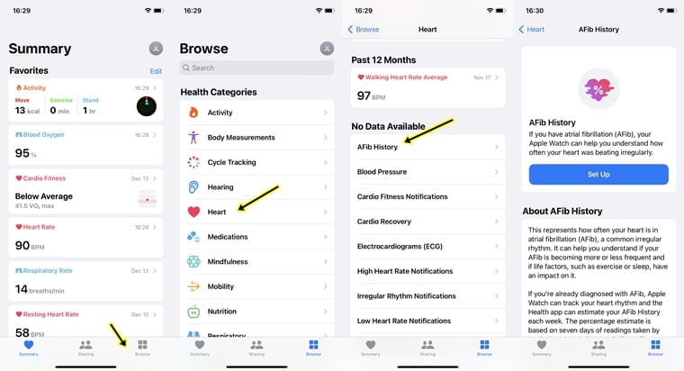 How to setup and track AFib history with Apple Watch 7